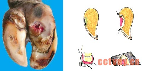 \