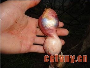 腺胃炎