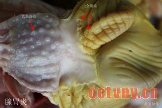 腺胃炎新变化