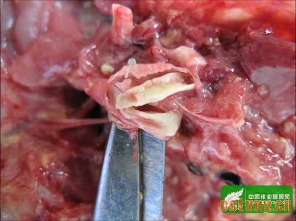 心包炎、肝周炎